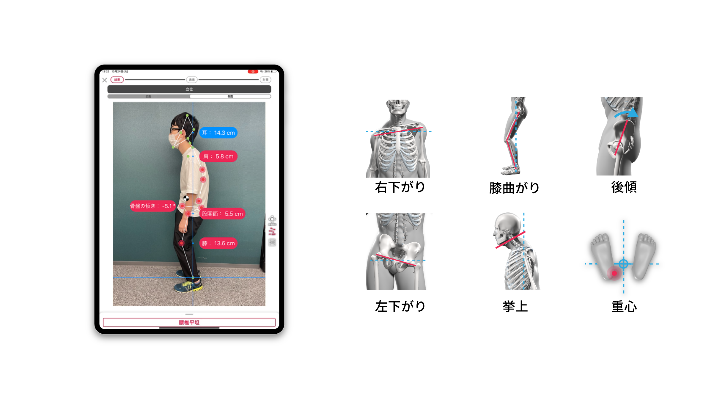 腰痛や姿勢改善に特化した施術